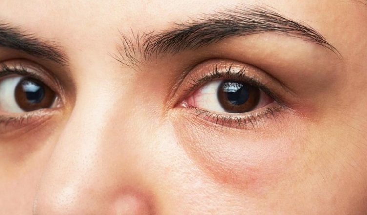 qeskat-nen-sy-si-t-i-parandaloni-dhe-largoni